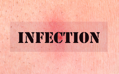 Common Bacterial Skin infections CME